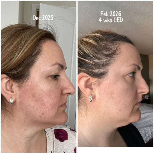 Novéa LED Therapy Mask